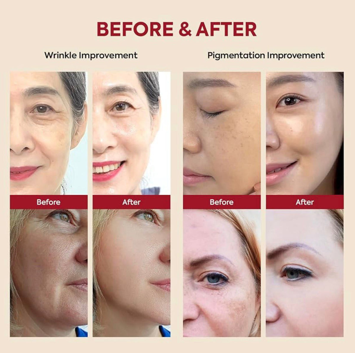 Seoul 1988 Serum Retinal
